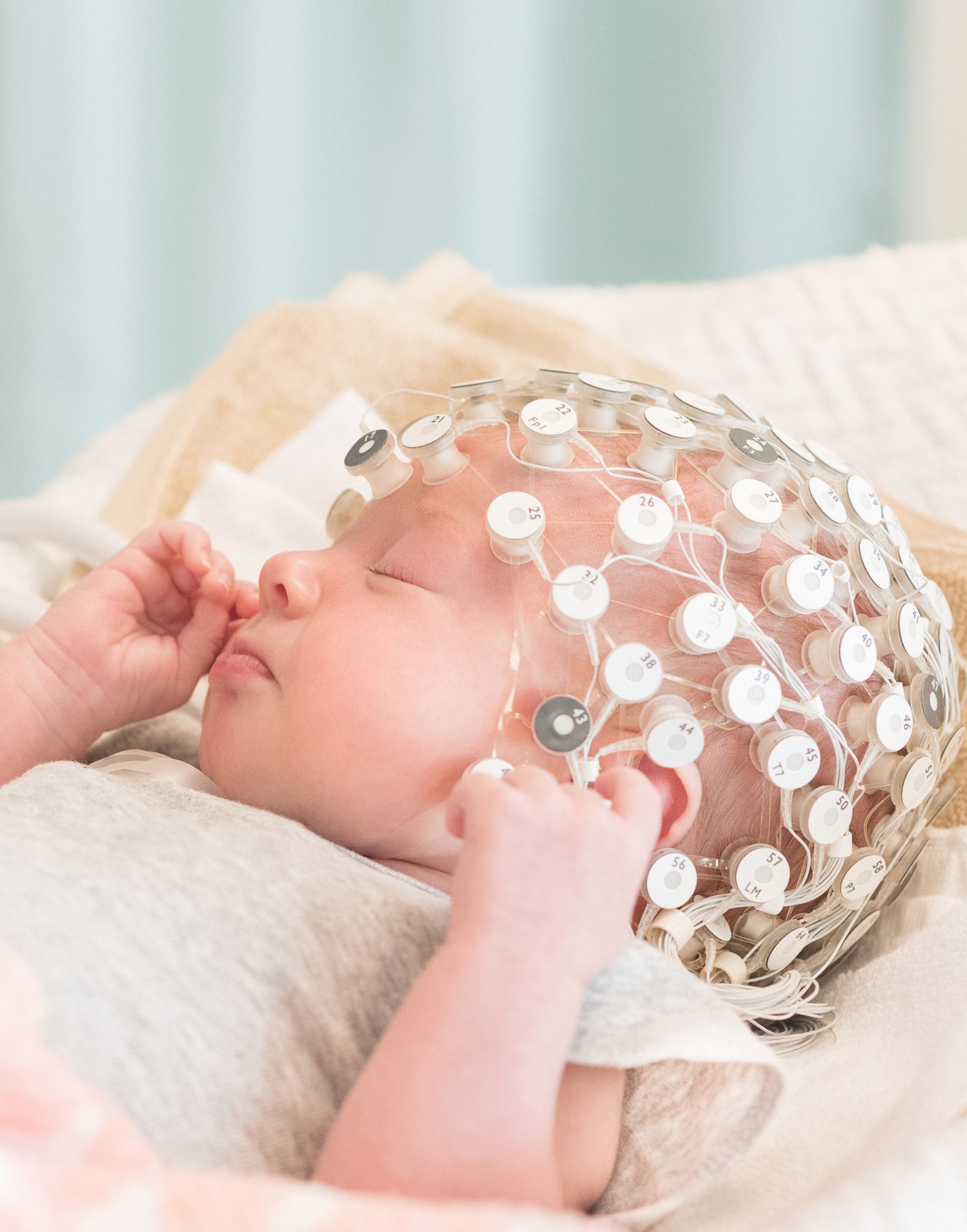 Nourrisson portant un filet Geodesic Sensor Net pour une acquisition EEG